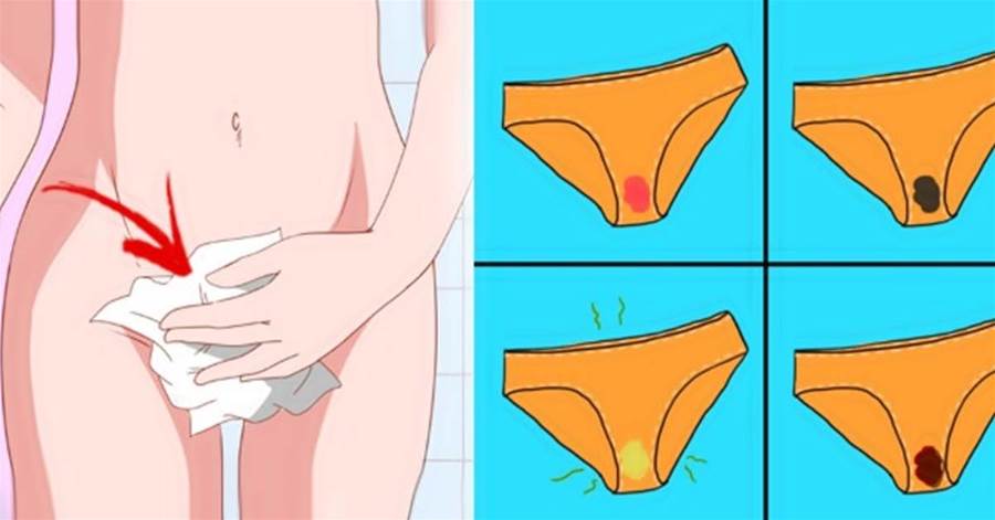 8 tipos de corrimento vaginal e o que eles dizem sobre sua saúde!
